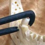 antique dental pelican tooth extractor
