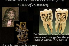 Tooth worm doesn't cause decay